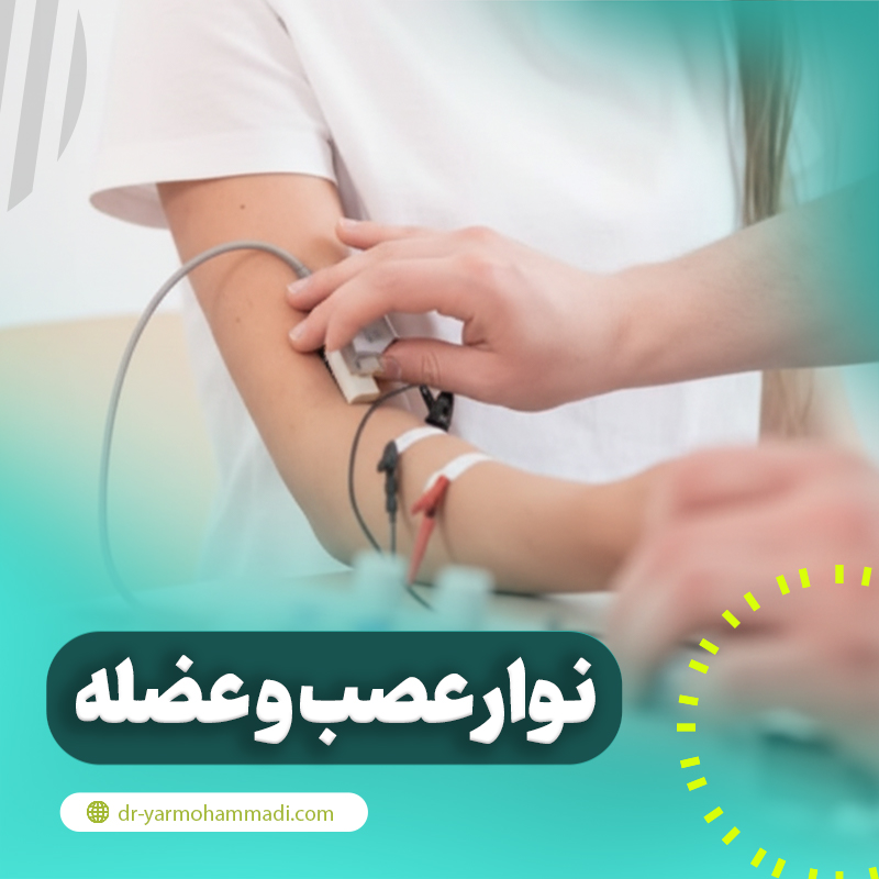 نوار عصب و عضله چیست؟