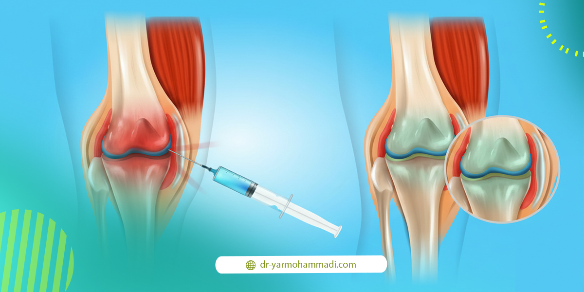 کاربردهای اوزون درمانی