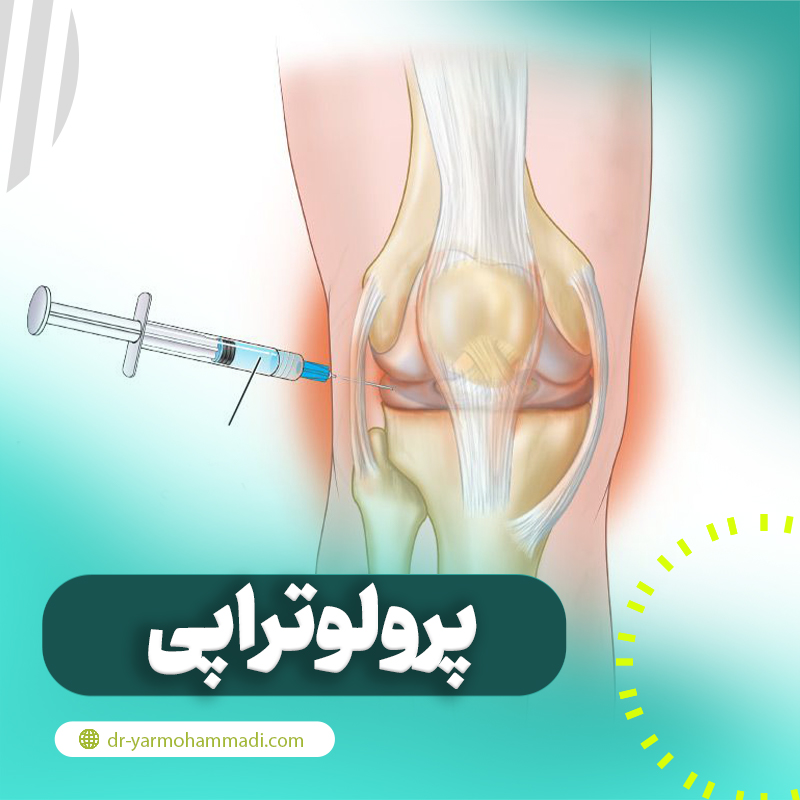 پرولوتراپی چیست و چه کاربردی دارد؟