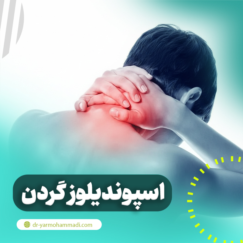 اسپوندیلوز یا آرتروز گردن چیست؟