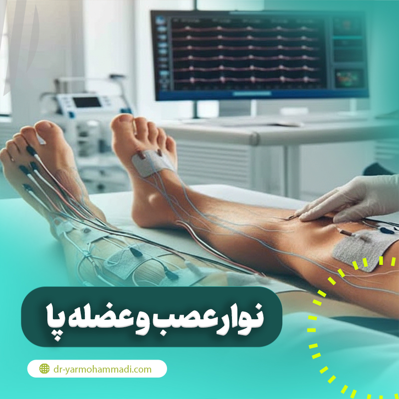 نوار عصب و عضله پا برای چیست و چگونه انجام می شود؟