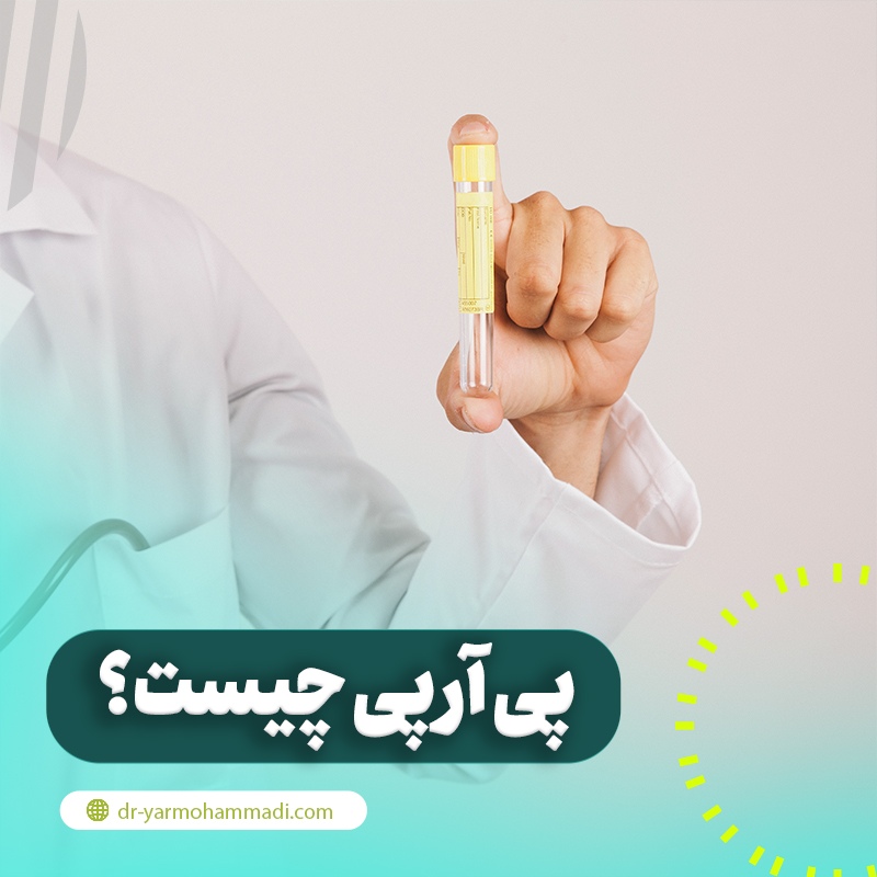 پی آر پی چیست؟