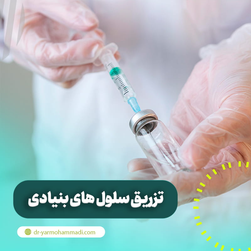 تزریق سلول های بنیادی